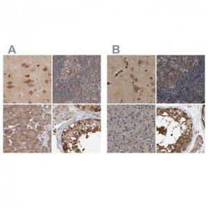 Anti-CCT8 antibody produced in rabbit 