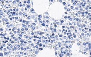 Anti-CD11b Antibody, clone 2G13 ZooMAb Rabbit Monoclonal 
