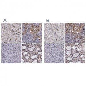 Anti-CD14 antibody produced in rabbit 