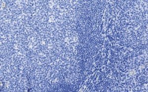 Anti-CD19 Antibody, clone 3E7 ZooMAb Rabbit Monoclonal 