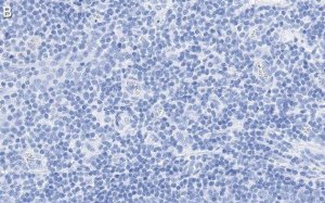 Anti-CD28 Antibody, clone 2N15 ZooMAb Rabbit Monoclonal 