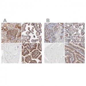 Anti-CD2AP antibody produced in rabbit 