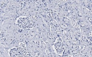 Anti-CD34 Antibody, clone 5C15 , ZooMAb Rabbit Monoclonal 