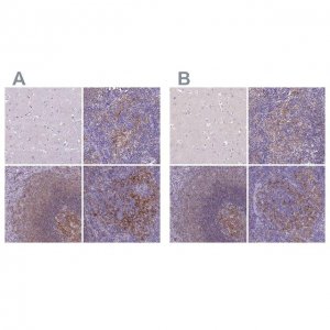 Anti-CD40 antibody produced in rabbit 
