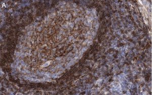 Anti-CD73 (NT5E) Antibody, clone 1F22 ZooMAb Rabbit Monoclonal 