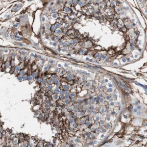 Anti-CD81 antibody produced in rabbit 