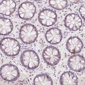 Anti-CD83 antibody produced in rabbit 
