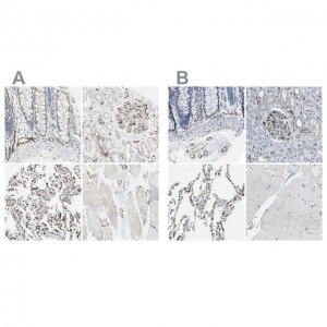 Anti-CD93 antibody produced in rabbit 