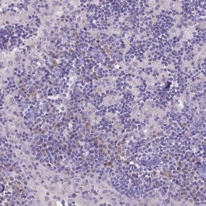 Anti-CD96 antibody produced in rabbit 
