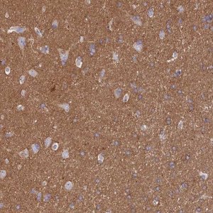 Anti-CD99L2 antibody produced in rabbit HPA038782-100UL