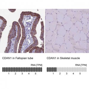 Anti-CDAN1 antibody produced in rabbit HPA040787-100UL