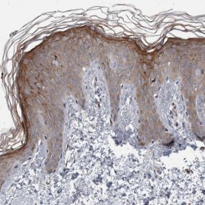 Anti-CDC42BPG antibody produced in rabbit 