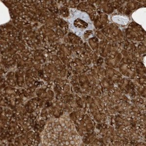 Anti-CDC42EP3 antibody produced in rabbit 
