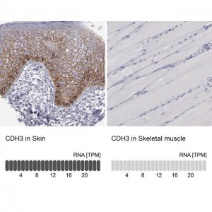 Anti-CDH3 antibody produced in rabbit 