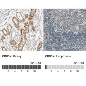 Anti-CDH6 antibody produced in rabbit 