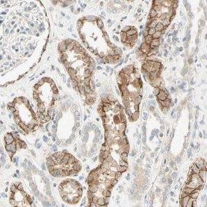 Anti-CDH6 antibody produced in rabbit 