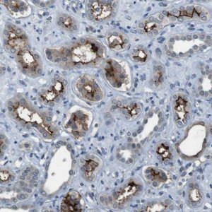Anti-CDHR2 antibody produced in rabbit 