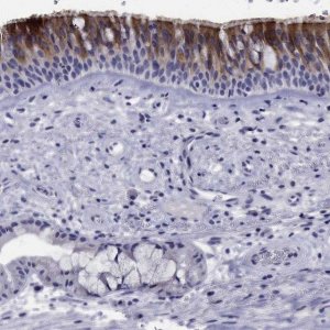 Anti-CDHR3 antibody produced in rabbit 