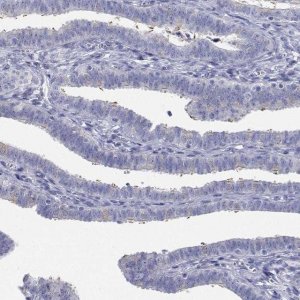 Anti-CDHR3 antibody produced in rabbit 