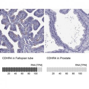 Anti-CDHR4 