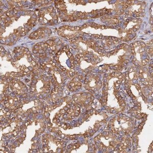 Anti-CDK18 antibody produced in rabbit HPA045429-100UL