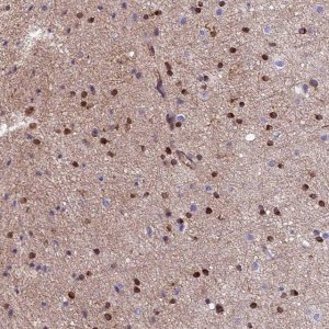 Anti-CDK18 antibody produced in rabbit HPA045429-100UL