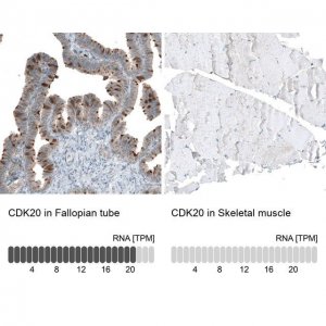 Anti-CDK20 antibody produced in rabbit 