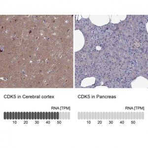 Anti-CDK5 antibody produced in rabbit 