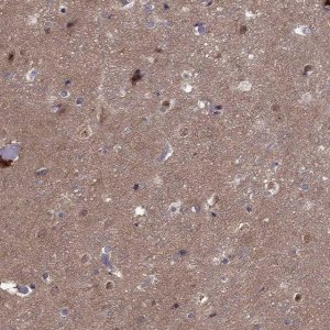 Anti-CDK5 antibody produced in rabbit 