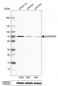 Anti-CDK5RAP3 antibody produced in rabbit 