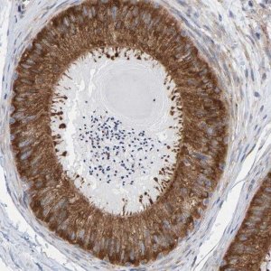 Anti-CDK5RAP3 antibody produced in rabbit 