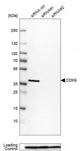 Anti-CDK6 antibody produced in rabbit 