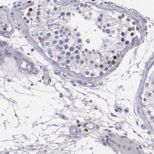 Anti-CDKL5 antibody produced in rabbit HPA002847-100UL