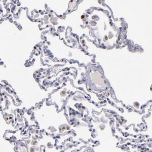 Anti-CDKL5 antibody produced in rabbit HPA002847-100UL