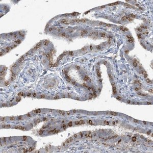 Anti-CDS1 antibody produced in rabbit 