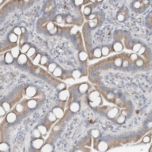 Anti-CDS1 antibody produced in rabbit 