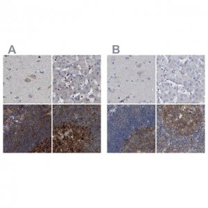 Anti-CDV3 antibody produced in rabbit 