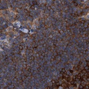 Anti-CDV3 antibody produced in rabbit 