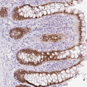 Anti-CDX1 antibody produced in rabbit 