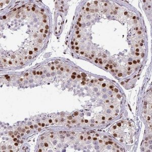 Anti-CDYL antibody produced in rabbit 