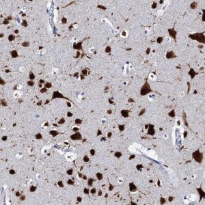 Anti-CELF2 antibody produced in rabbit 