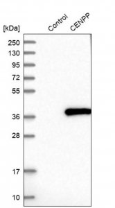 Anti-CENPP antibody produced in rabbit 