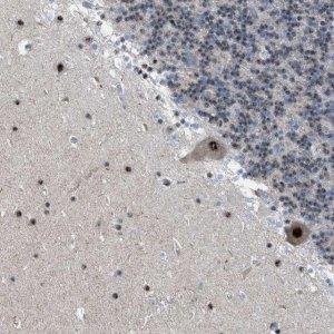 Anti-CENPP antibody produced in rabbit 