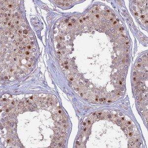 Anti-CENPV antibody produced in rabbit 