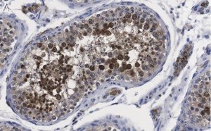 Anti-Centrin Antibody, clone 20H5 ZooMAb Mouse Monoclonal 