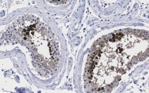 Anti-Centrin-1 Antibody, clone 5L17 ZooMAb Rabbit Monoclonal 