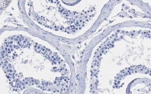 Anti-Centrin-1 Antibody, clone 5L17 ZooMAb Rabbit Monoclonal 