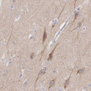Anti-CEP170B antibody produced in rabbit 