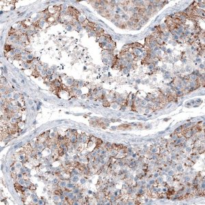 Anti-CEP192 antibody produced in rabbit 