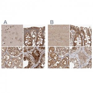 Anti-CEP350 antibody produced in rabbit 